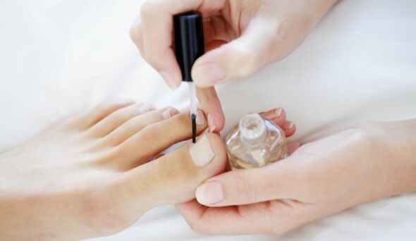 L'application de vernis à ongles médicamenteux est une procédure quotidienne obligatoire lors d'un traitement fongique. 